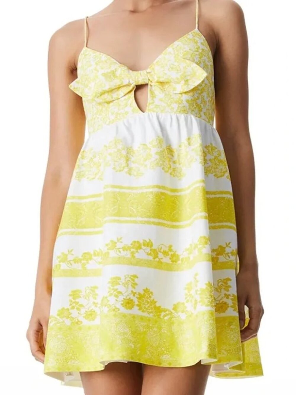 Like New Alice + Olivia Melvina BabyDoll Dress - Size 0